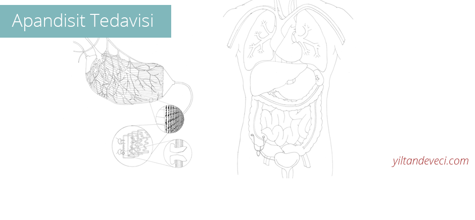 Apandisit Tedavisi